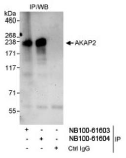 Immunoprecipitation: AKAP2 Antibody [NB100-61604] - Detection of Human AKAP2 on HeLa whole cell lysate using anti-AKAP2 antibody NB100-61604 used for IP at 3 mcg/mg  lysate. AKAP2 was also immunoprecipitated by rabbit anti-  AKAP2 antibody NB100-61603.