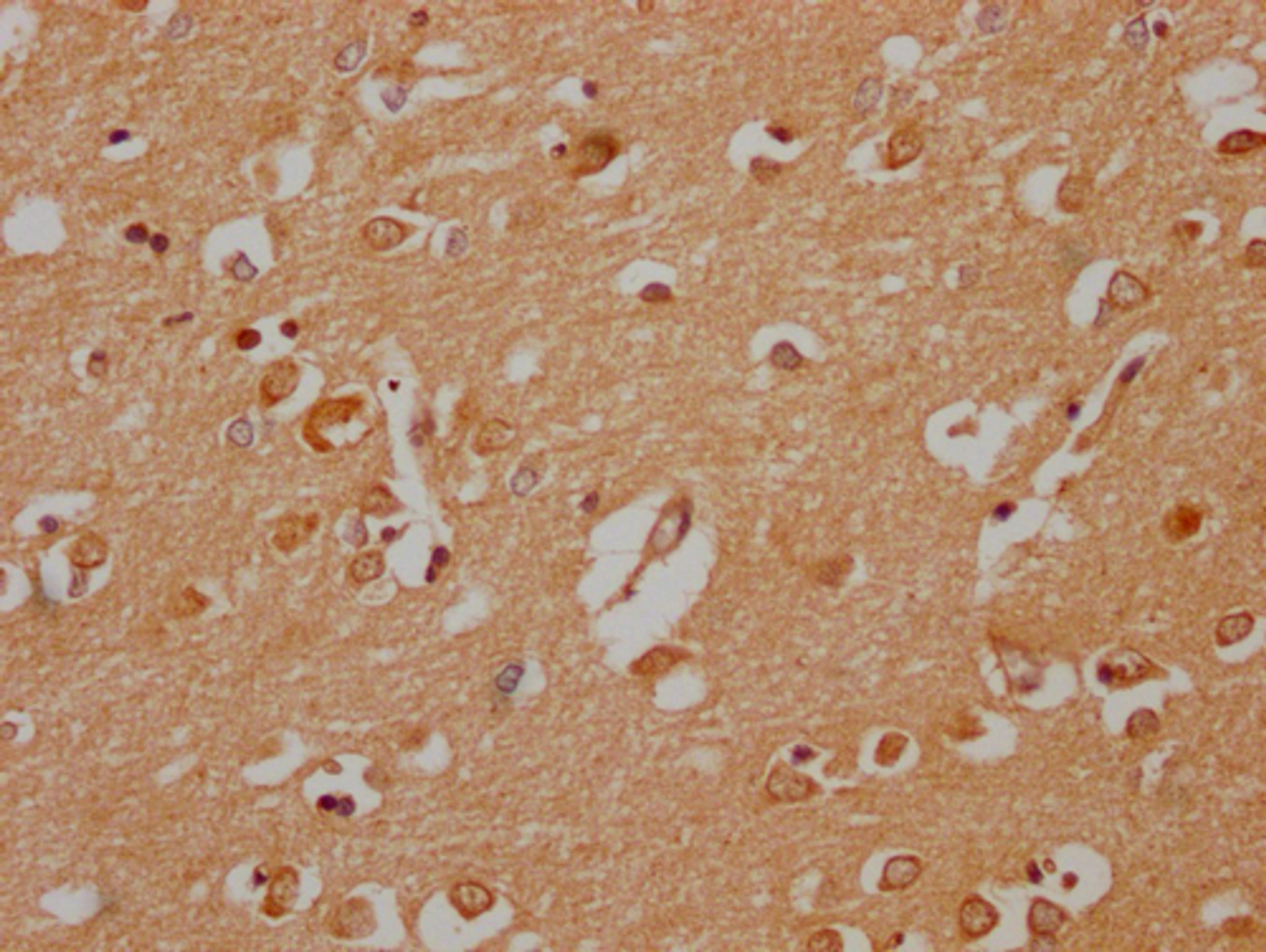IHC image of CSB-PA030070HA01HU diluted at 1:200 and staining in paraffin-embedded human brain tissue performed on a Leica BondTM system. After dewaxing and hydration, antigen retrieval was mediated by high pressure in a citrate buffer (pH 6.0). Section was blocked with 10% normal goat serum 30min at RT. Then primary antibody (1% BSA) was incubated at 4°C overnight. The primary is detected by a Goat anti-rabbit polymer IgG labeled by HRP and visualized using 0.05% DAB.