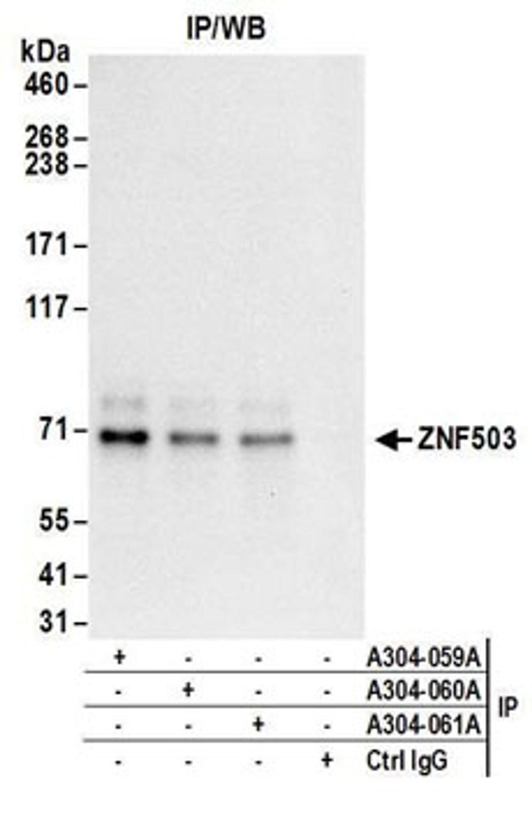 Detection of human ZNF503 by western blot of immunoprecipitates.