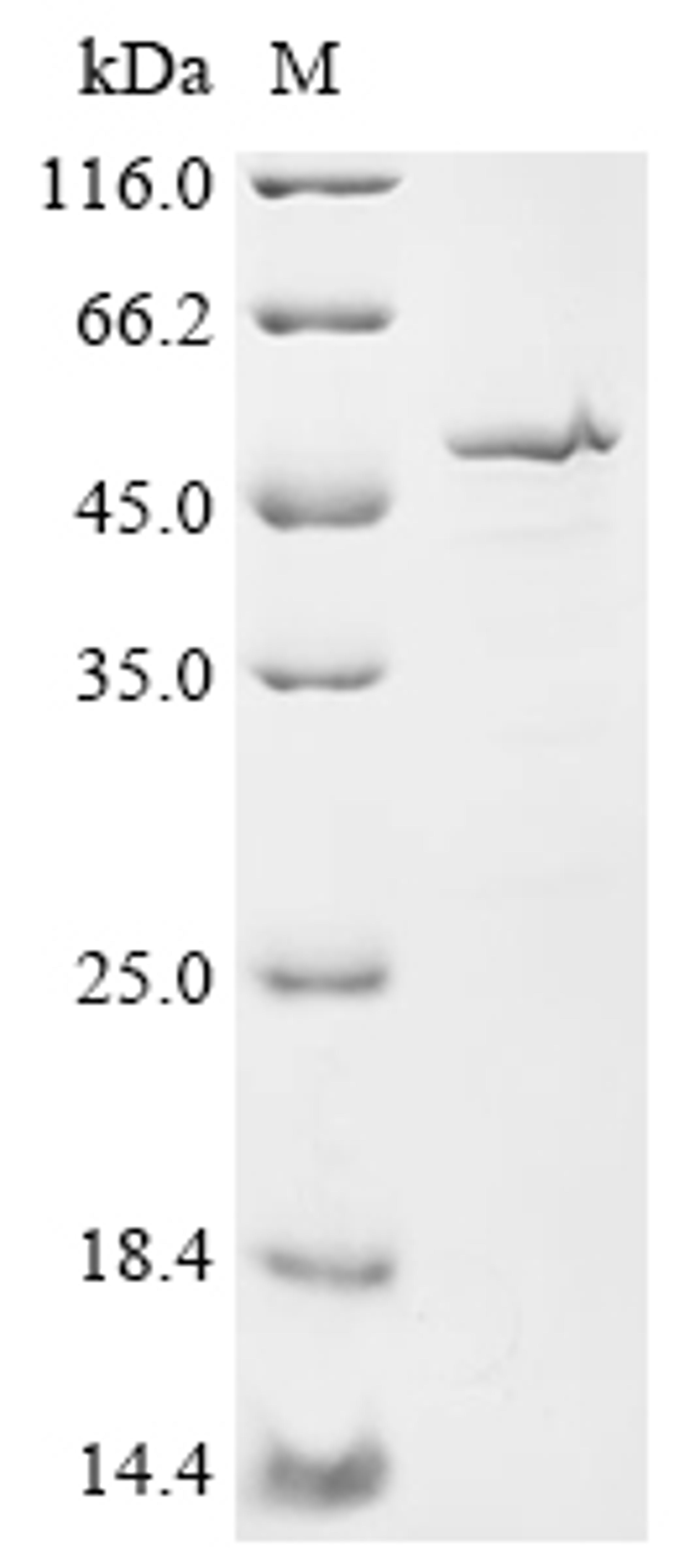 (Tris-Glycine gel) Discontinuous SDS-PAGE (reduced) with 5% enrichment gel and 15% separation gel.