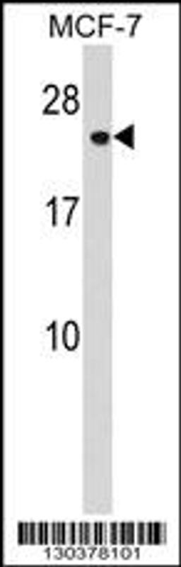 Western blot analysis in MCF-7 cell line lysates (35ug/lane).