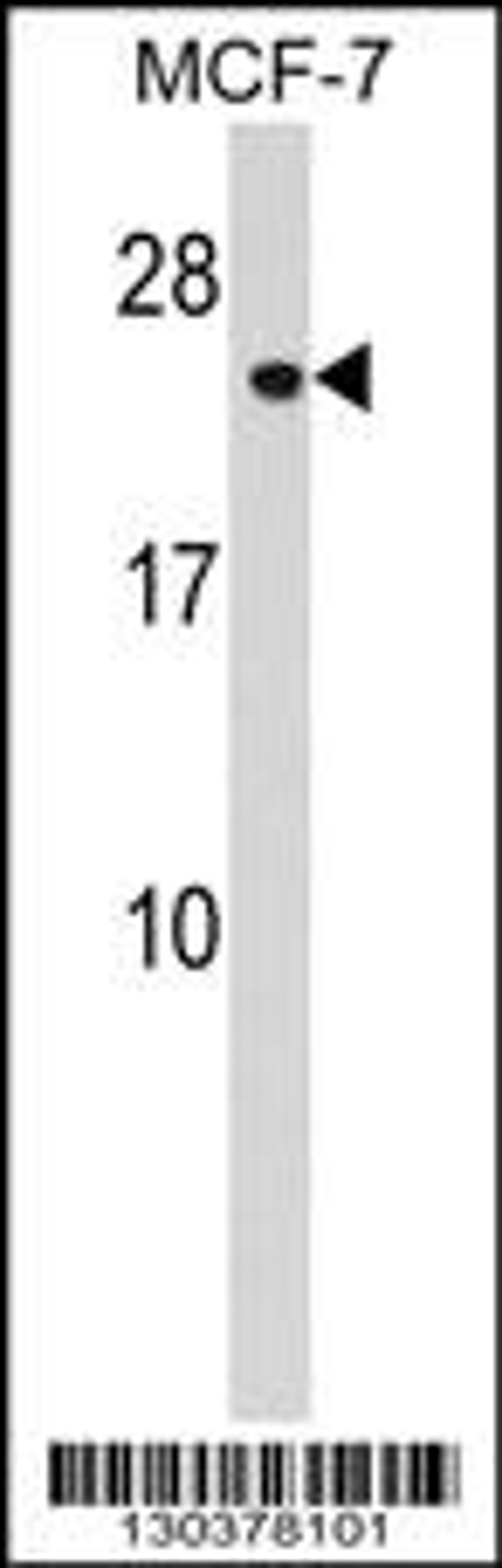 Western blot analysis in MCF-7 cell line lysates (35ug/lane).