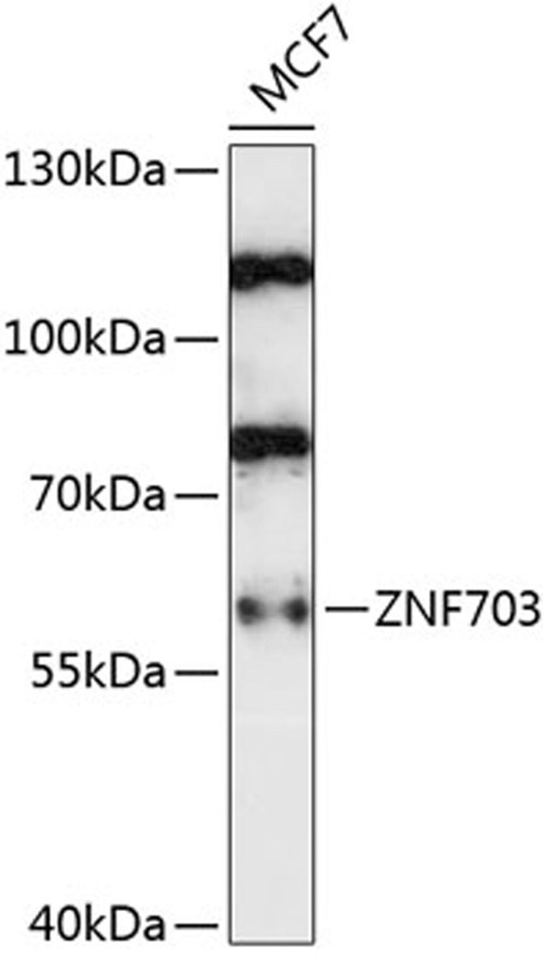 Western blot - ZNF703 antibody (A14325)