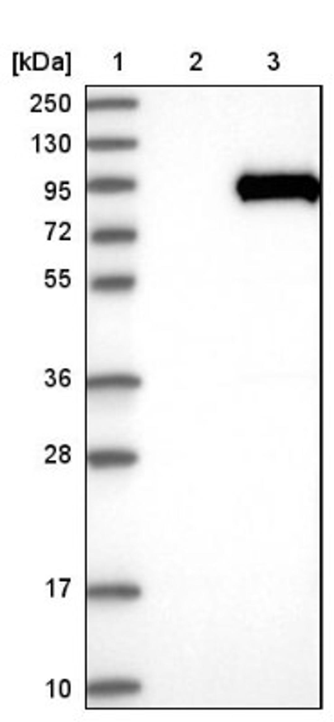 Western Blot: DNAI1 Antibody [NBP1-84466] - Lane 1: Marker [kDa] 250, 130, 95, 72, 55, 36, 28, 17, 10<br/>Lane 2: Negative control (vector only transfected HEK293T lysate)<br/>Lane 3: Over-expression lysate (Co-expressed with a C-terminal myc-DDK tag (~3.1 kDa) in mammalian HEK293T cells, LY402158)