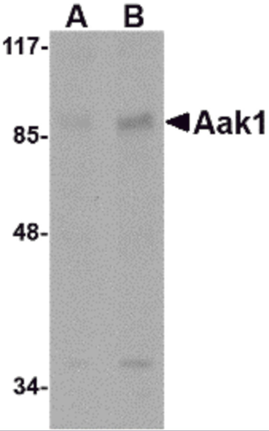 Western blot analysis of Aak1 in A-20 lysate with Aak1 antibody at (A) 1 and (B) 2 &#956;g/mL.