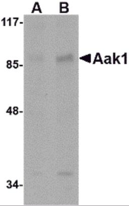 Western blot analysis of Aak1 in A-20 lysate with Aak1 antibody at (A) 1 and (B) 2 μg/mL.