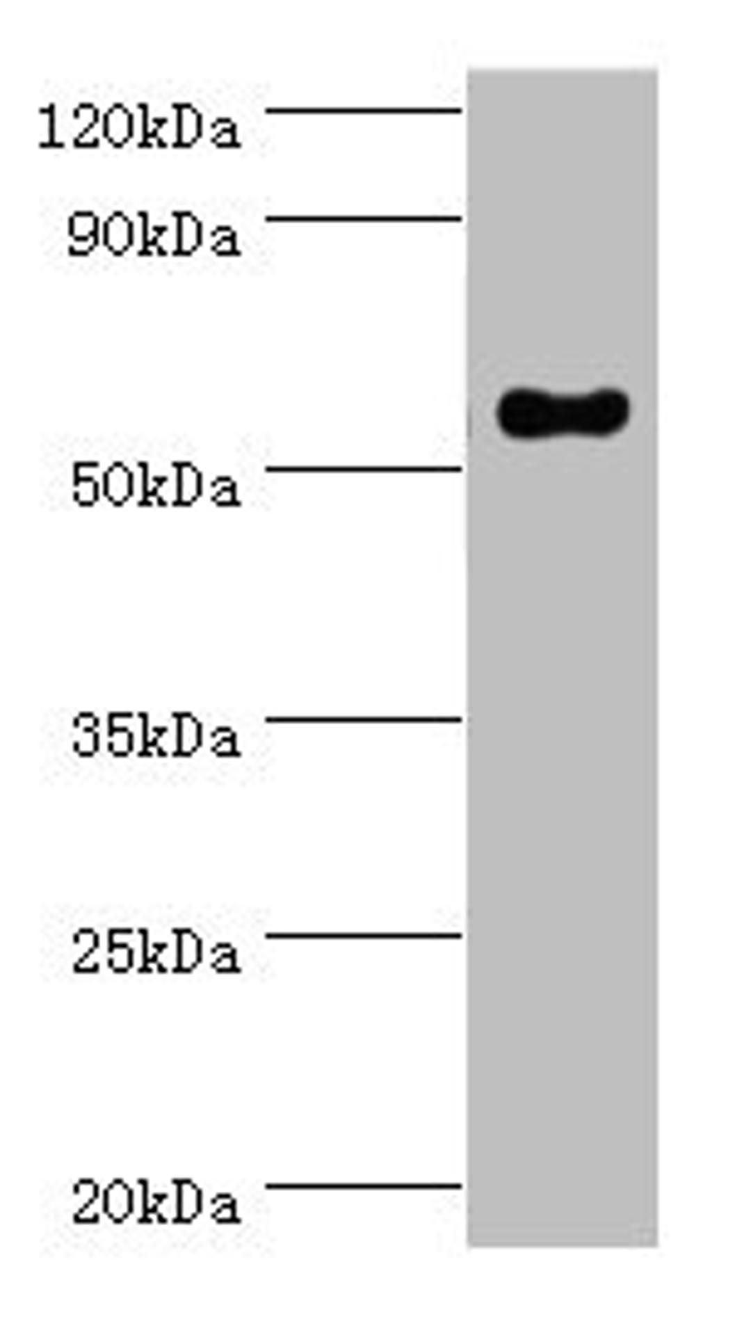 Western blot. All lanes: IFNGR1 antibody at 2ug/ml + Mouse lung tissue. Secondary. Goat polyclonal to rabbit IgG at 1/10000 dilution. Predicted band size: 55, 22 kDa. Observed band size: 55 kDa.