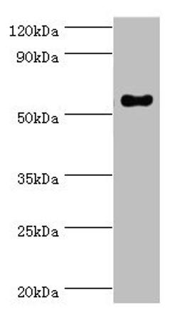 Western blot. All lanes: IFNGR1 antibody at 2ug/ml + Mouse lung tissue. Secondary. Goat polyclonal to rabbit IgG at 1/10000 dilution. Predicted band size: 55, 22 kDa. Observed band size: 55 kDa.