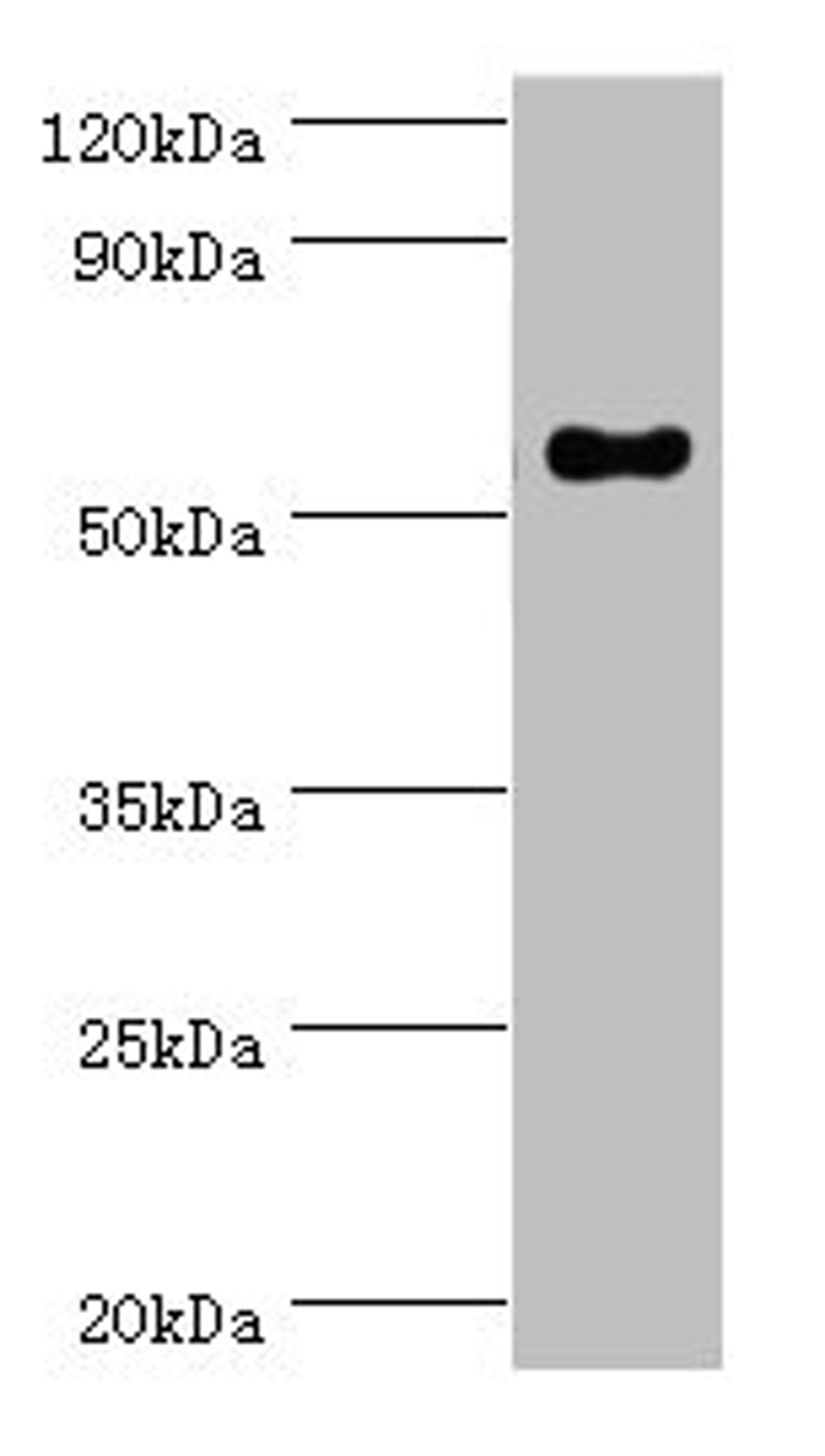 Western blot. All lanes: IFNGR1 antibody at 2ug/ml + Mouse lung tissue. Secondary. Goat polyclonal to rabbit IgG at 1/10000 dilution. Predicted band size: 55, 22 kDa. Observed band size: 55 kDa.