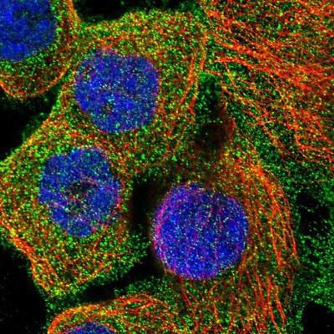 Immunocytochemistry/Immunofluorescence: Frizzled-6 Antibody [NBP1-89702] - Staining of human cell line A-431 shows positivity in plasma membrane.