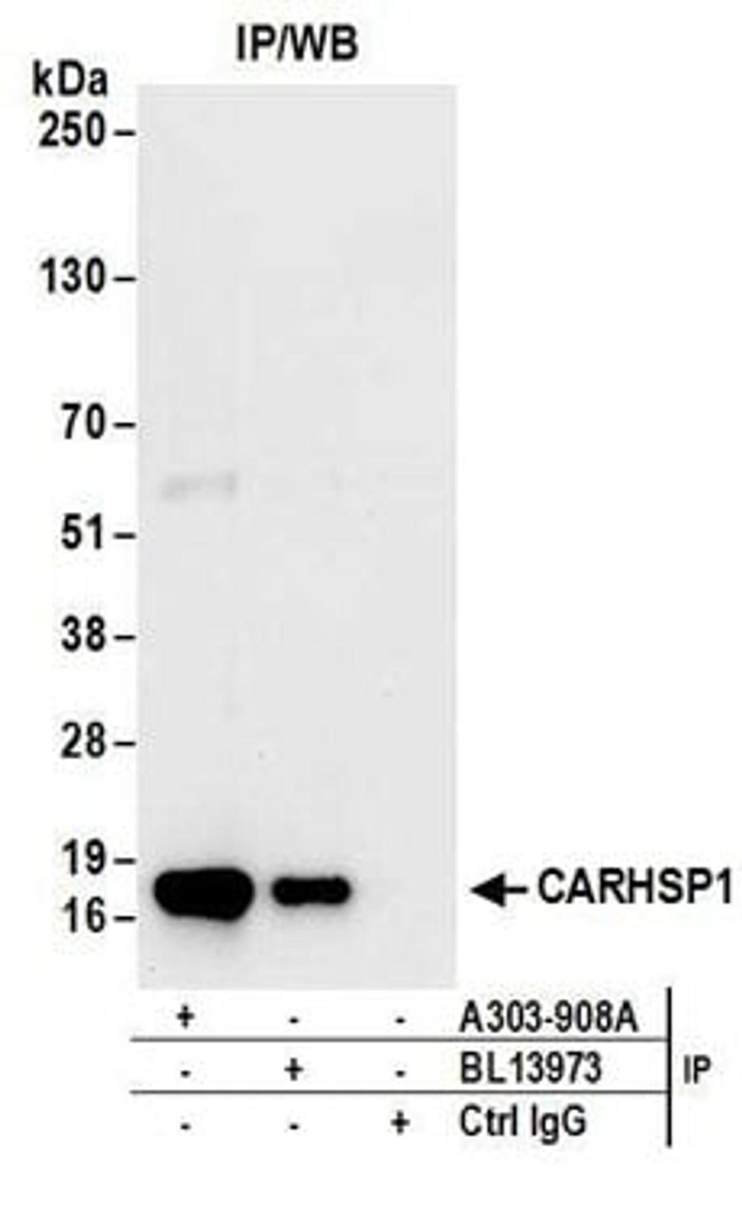 Detection of human CARHSP1 by western blot of immunoprecipitates.