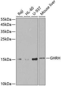 Western blot - GHRH antibody (A5343)