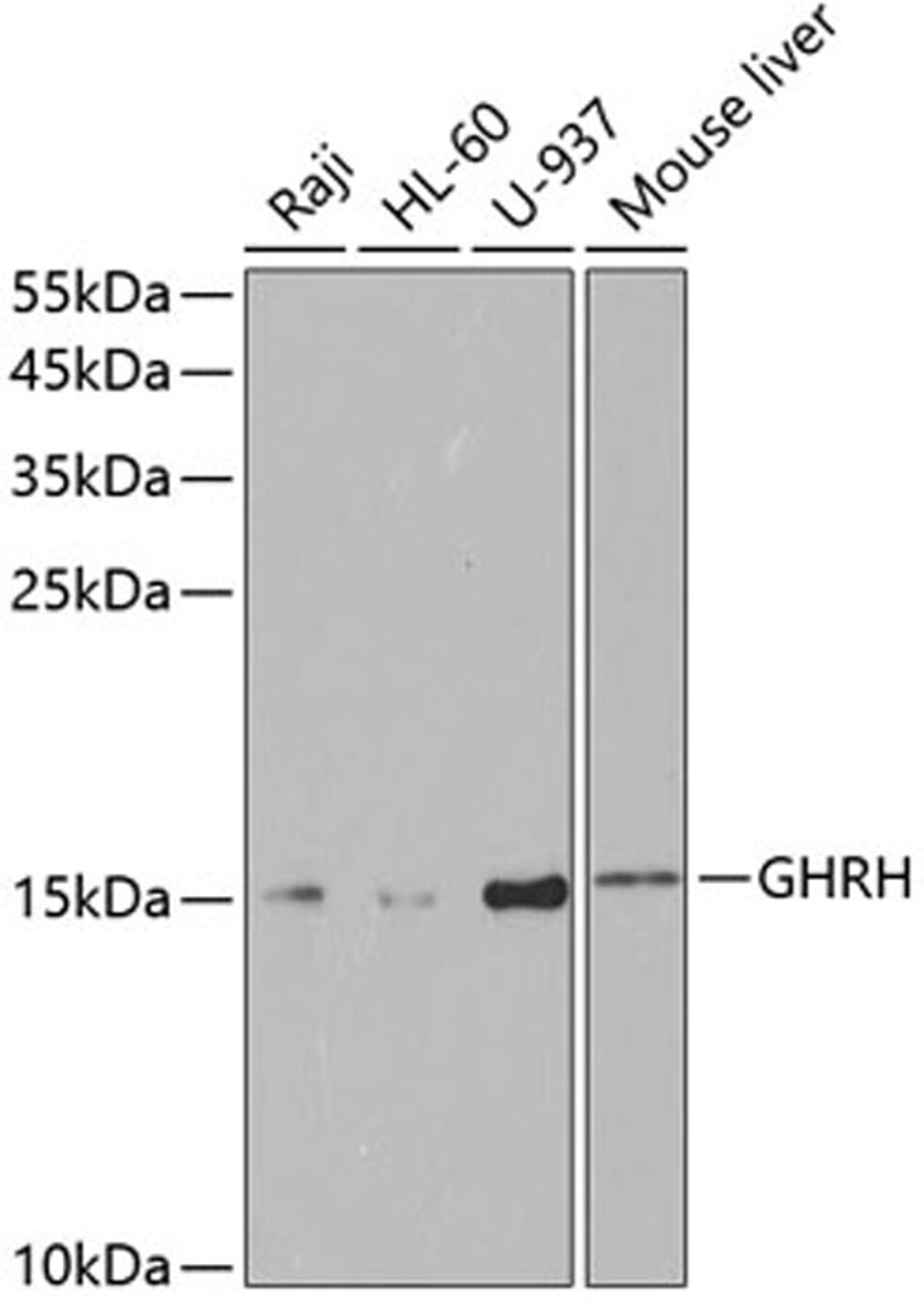 Western blot - GHRH antibody (A5343)