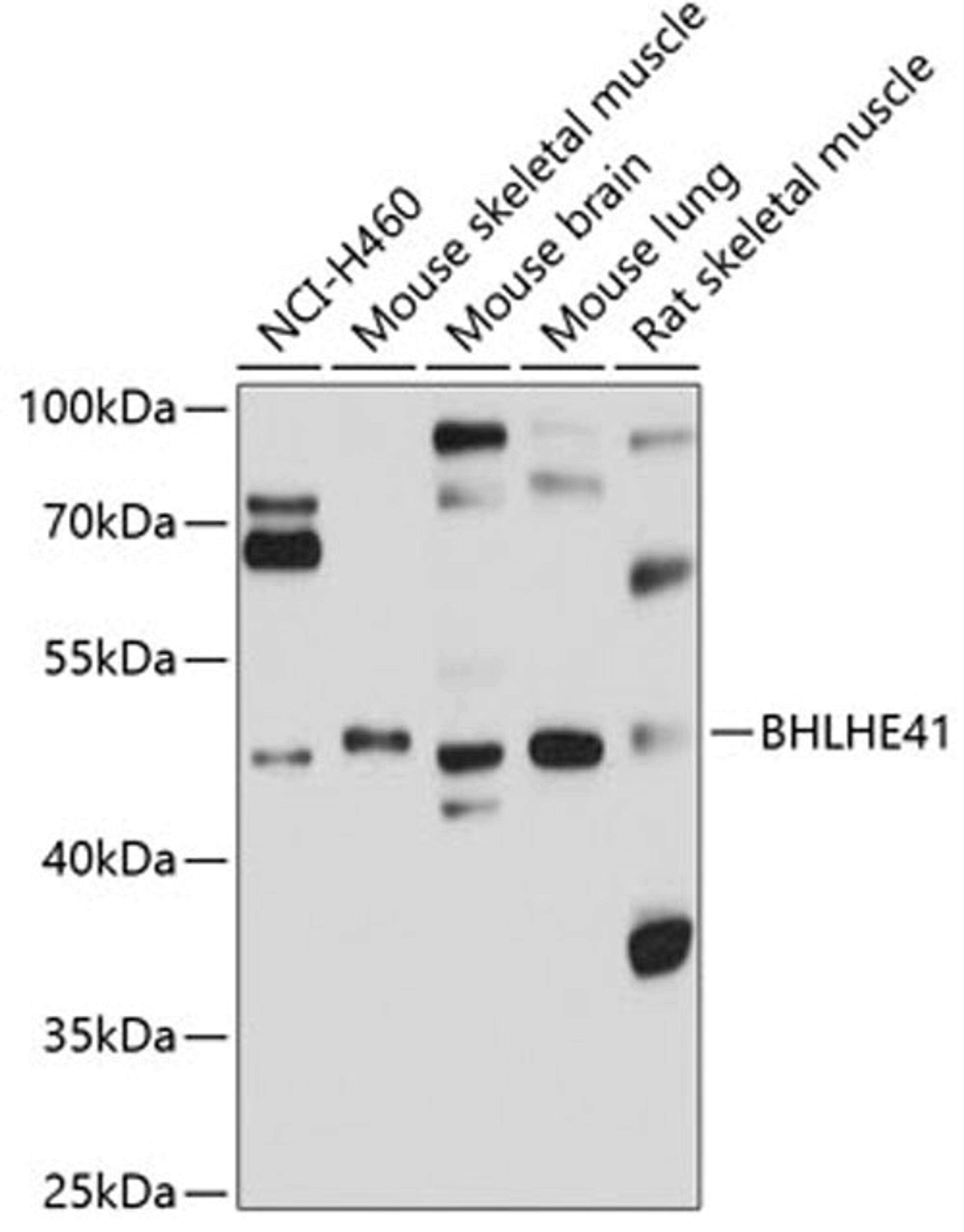 Western blot - BHLHE41 antibody (A10555)