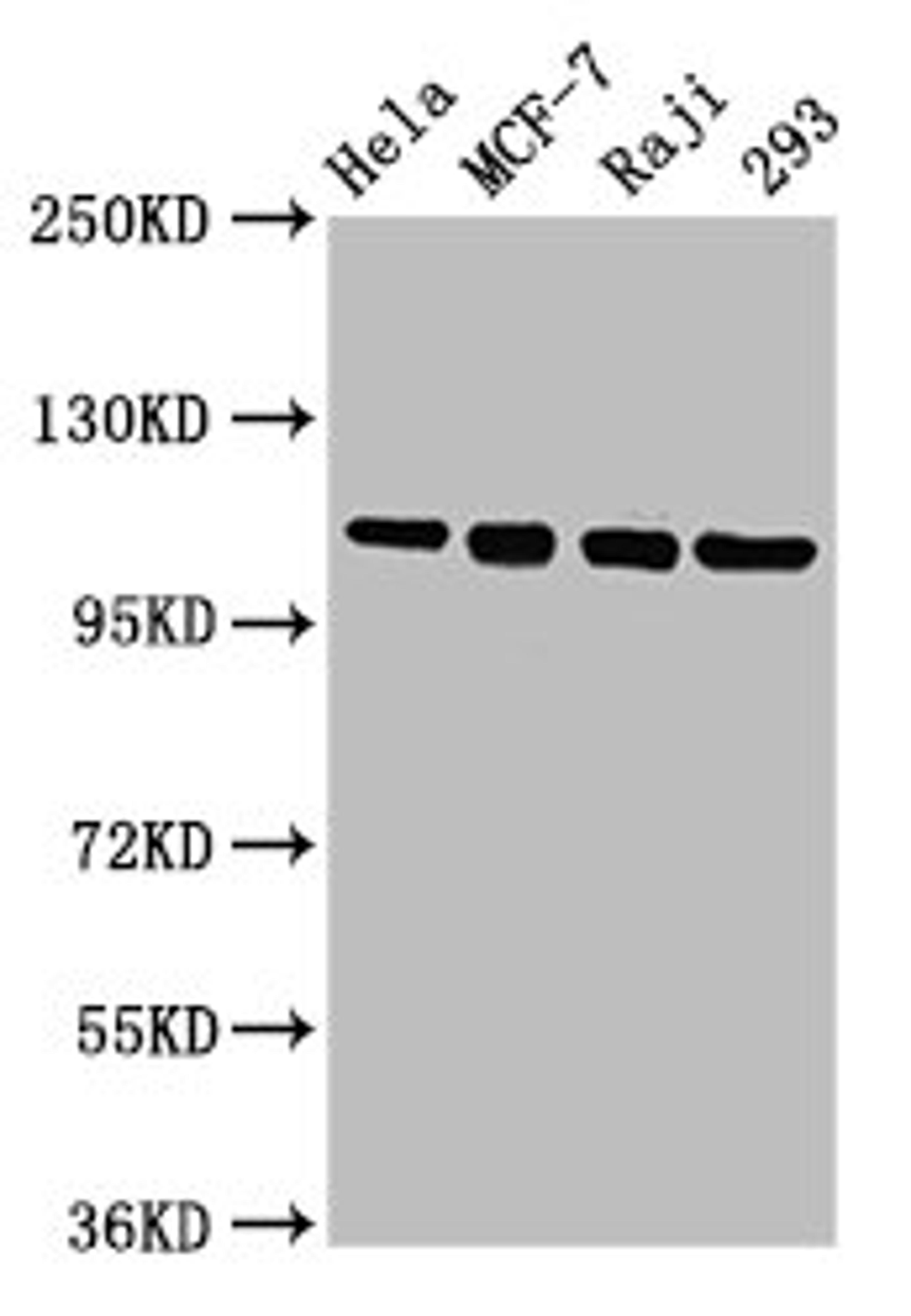 Western Blot. Positive WB detected in: Hela whole cell lysate, MCF-7 whole cell lysate, Raji whole cell lysate, 293 whole cell lysate. All lanes: MCM2 antibody at 4.8µg/ml. Secondary. Goat polyclonal to rabbit IgG at 1/50000 dilution. Predicted band size: 102 kDa. Observed band size: 102 kDa