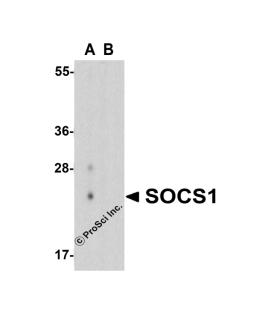 Western blot analysis of SOCS1 in human spleen tissue lysate with SOCS1 antibody at 1 μg/mL in (A) the absence and (B) the presence of blocking peptide