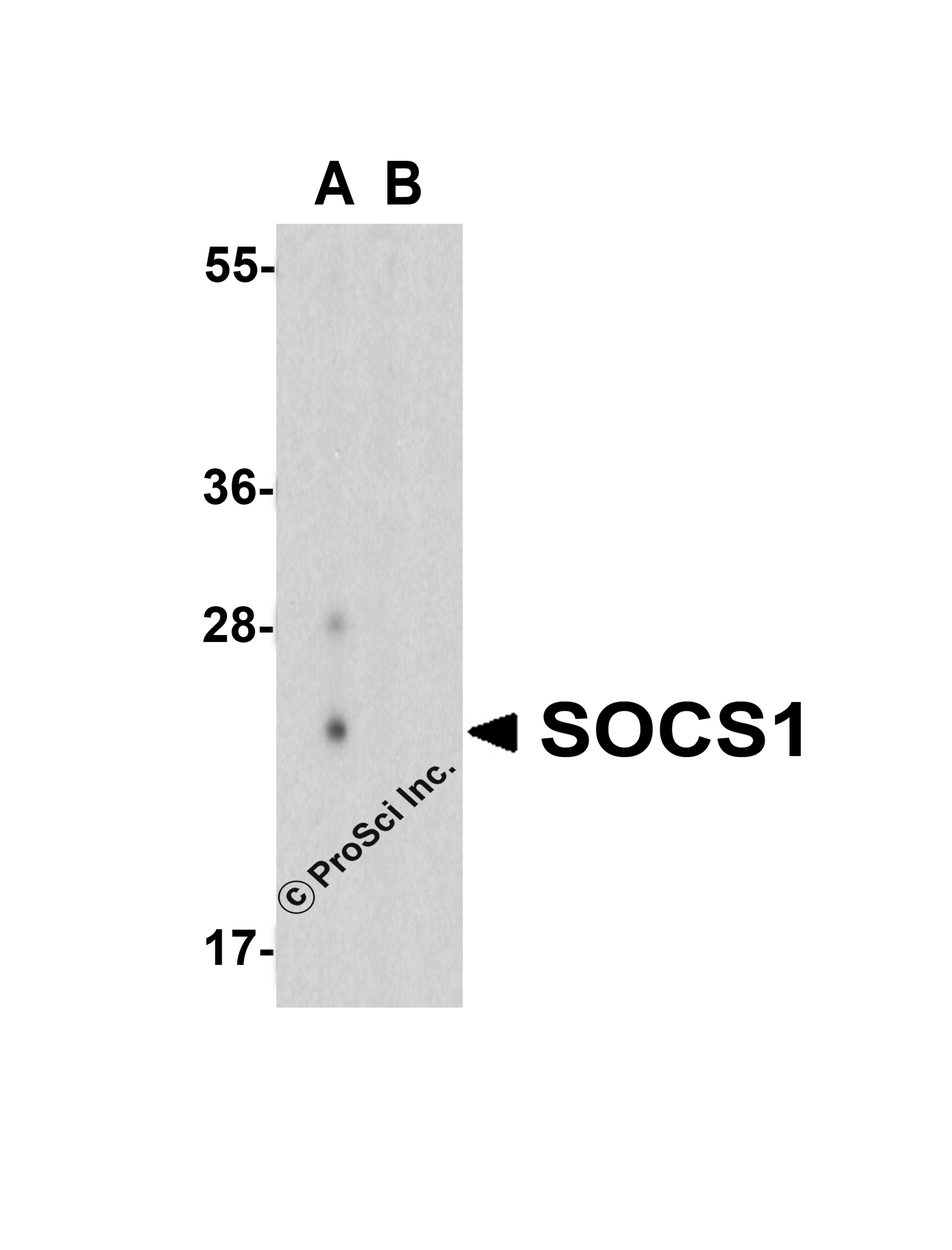 Western blot analysis of SOCS1 in human spleen tissue lysate with SOCS1 antibody at 1 μg/mL in (A) the absence and (B) the presence of blocking peptide