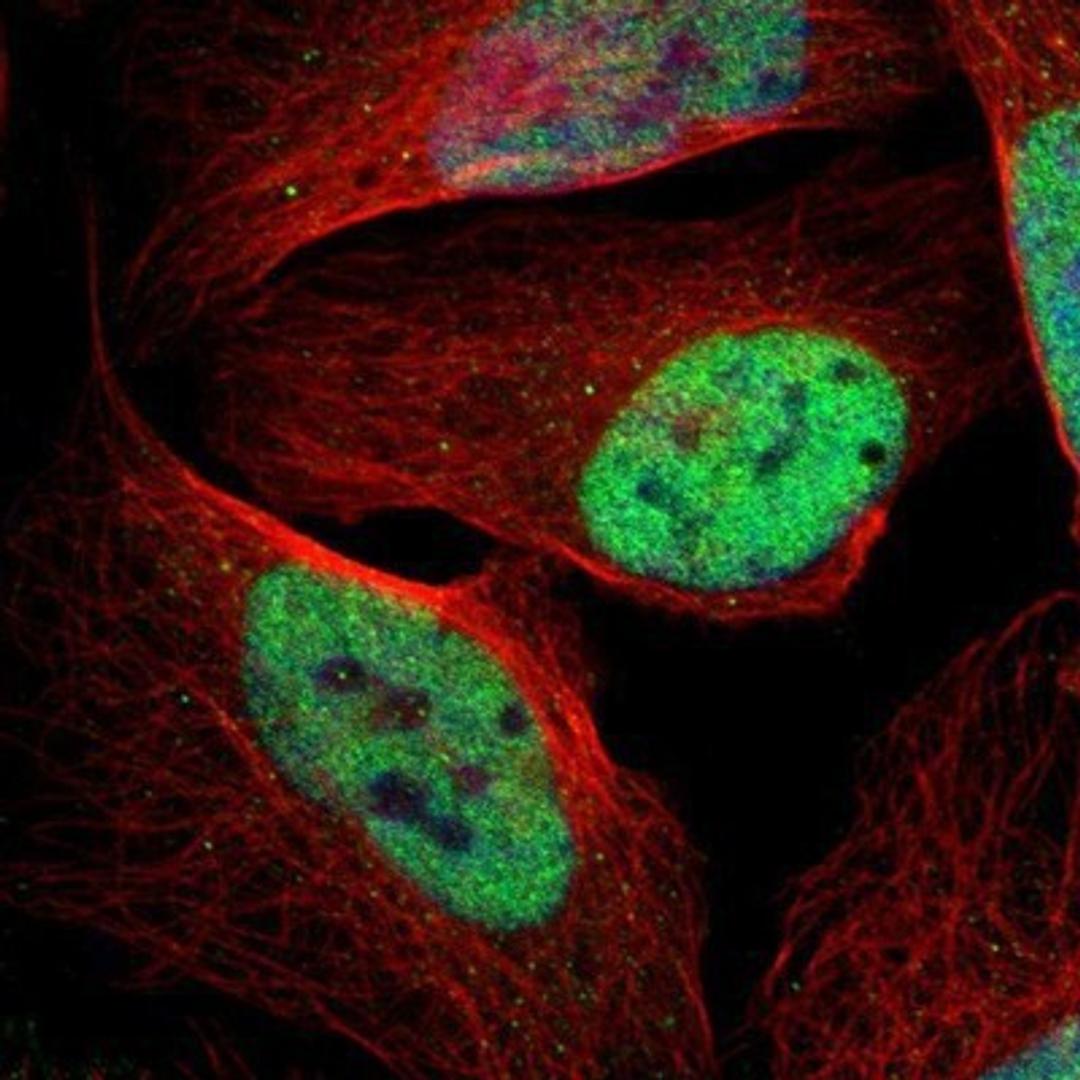 Immunocytochemistry/Immunofluorescence: p66 alpha Antibody [NBP1-87359] - Staining of human cell line U-2 OS shows positivity in nuclei but not nucleoli.