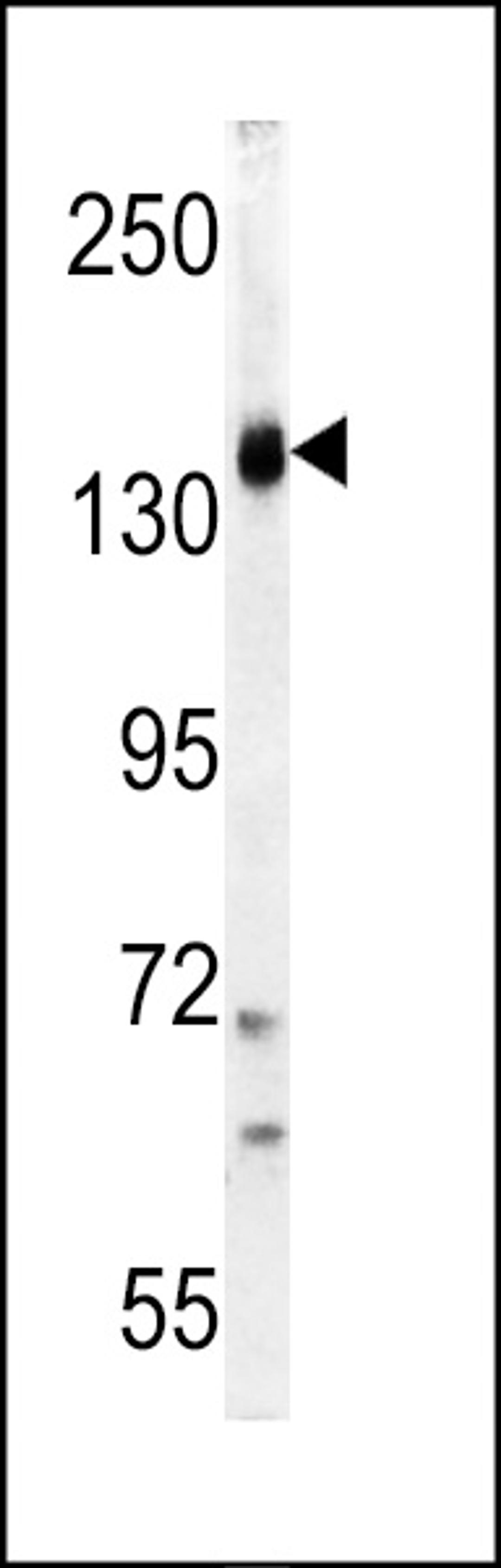 Western blot analysis of PI3KCG Antibody in K562 cell line lysates (35ug/lane)