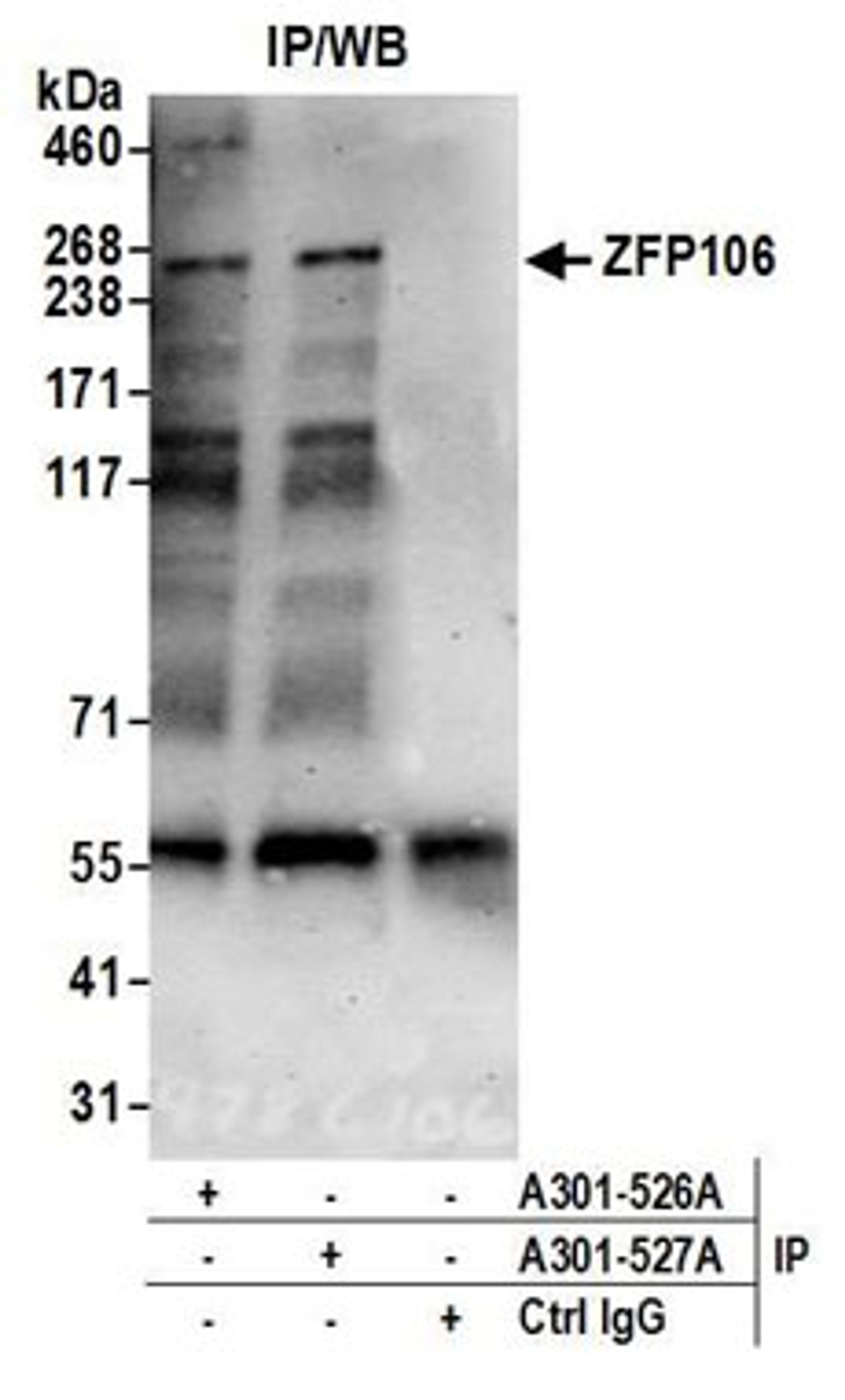 Detection of human ZFP106 by western blot of immunoprecipitates.