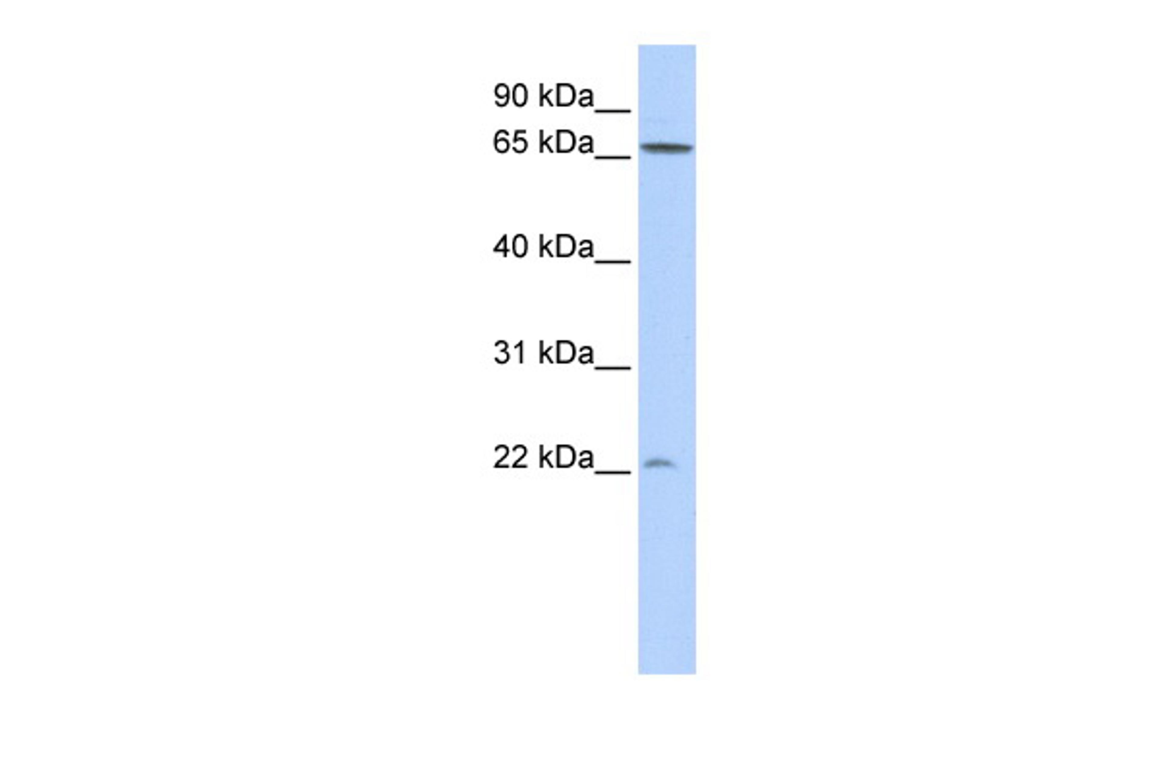 Antibody used in WB on Human 293T at 0.2-1 ug/ml.