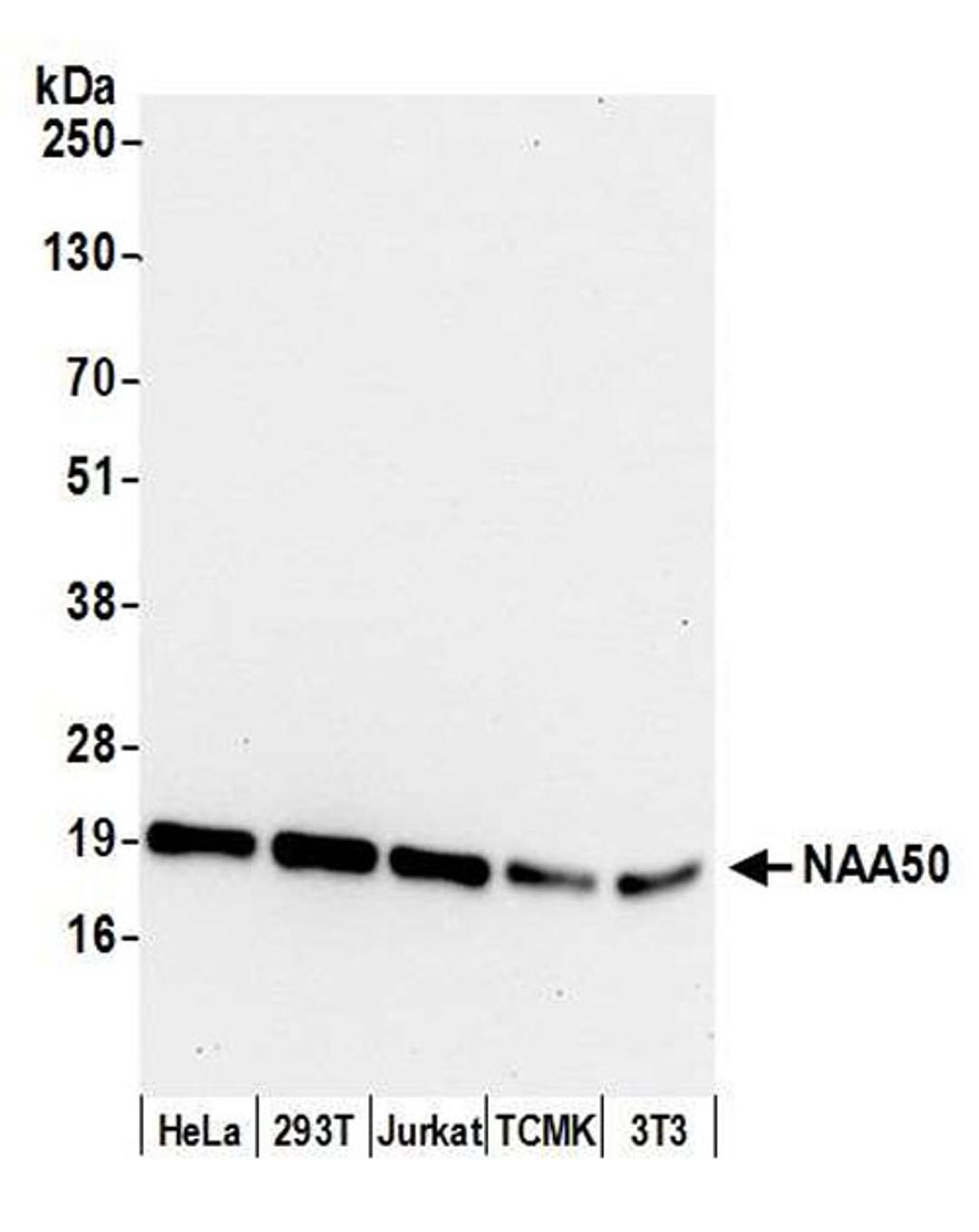 Detection of human and mouse NAA50 by WB.