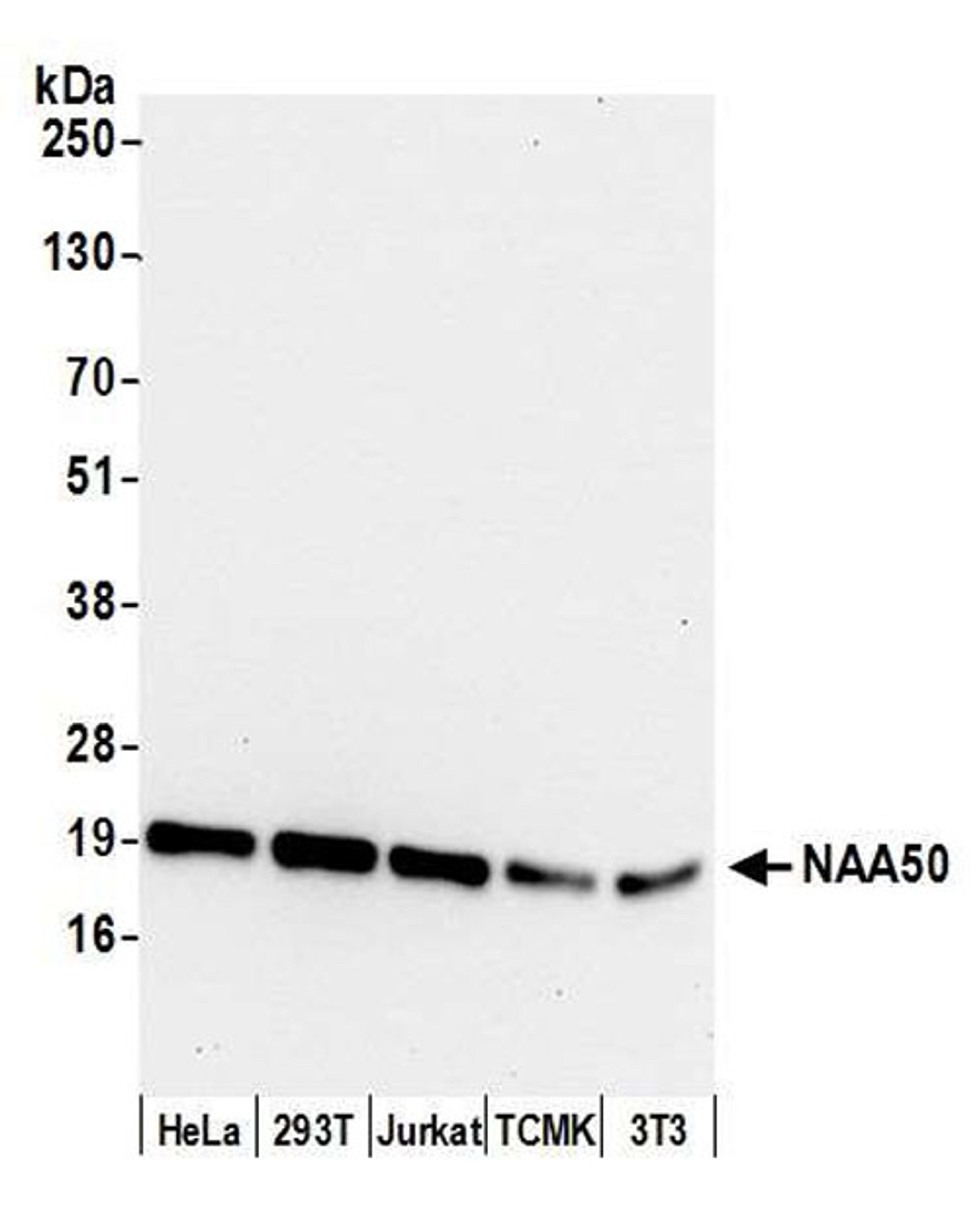 Detection of human and mouse NAA50 by WB.