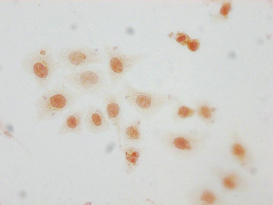 Immunocytochemistry analysis of CSB-PA010389PA29me1HU diluted at 1:10 and staining in Hela cells performed on a Leica BondTM system. The cells were fixed in 4% formaldehyde, permeabilized using 0.2% Triton X-100 and blocked with 10% normal goat serum 30min at RT. Then primary antibody (1% BSA) was incubated at 4°C overnight. The primary is detected by a biotinylated secondary antibody and visualized using an HRP conjugated SP system.