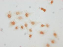 Immunocytochemistry analysis of CSB-PA010389PA29me1HU diluted at 1:10 and staining in Hela cells performed on a Leica BondTM system. The cells were fixed in 4% formaldehyde, permeabilized using 0.2% Triton X-100 and blocked with 10% normal goat serum 30min at RT. Then primary antibody (1% BSA) was incubated at 4°C overnight. The primary is detected by a biotinylated secondary antibody and visualized using an HRP conjugated SP system.