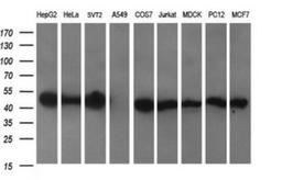 Western Blot: C2orf62 Antibody (4B4) [NBP2-45568] - Analysis of extracts (35ug) from 9 different cell lines by using C2orf62 monoclonal antibody (HepG2: human; HeLa: human; SVT2: mouse; A549: human; COS7: monkey; Jurkat: human; MDCK: canine; PC12: rat; MCF7: human)