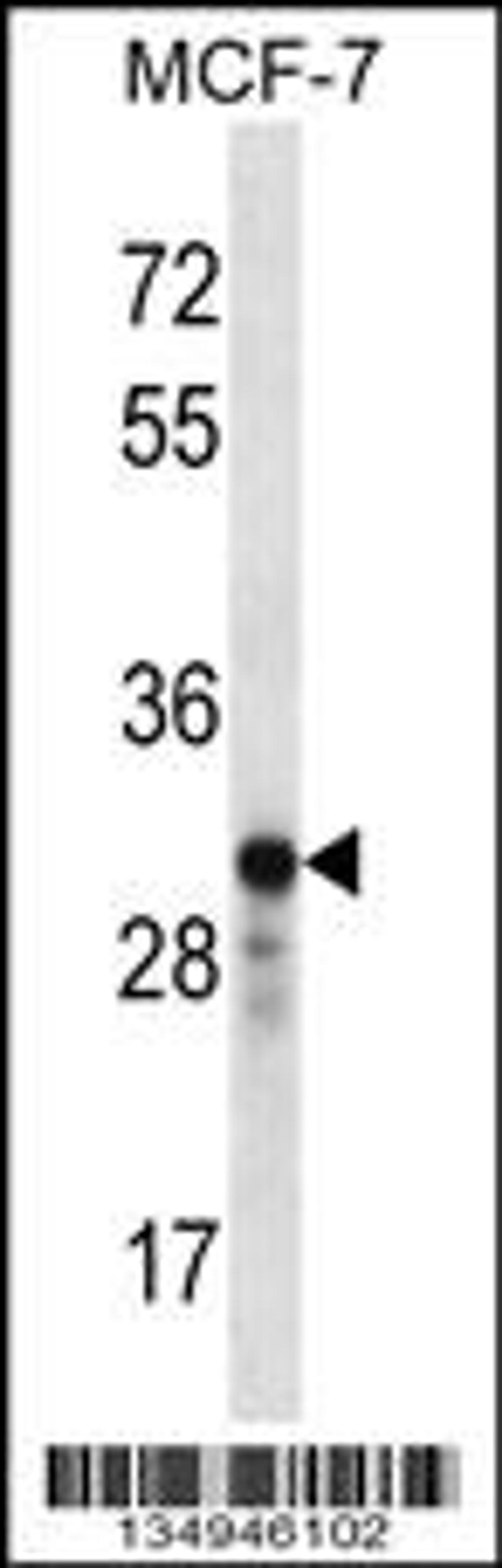 Western blot analysis in MCF-7 cell line lysates (35ug/lane).