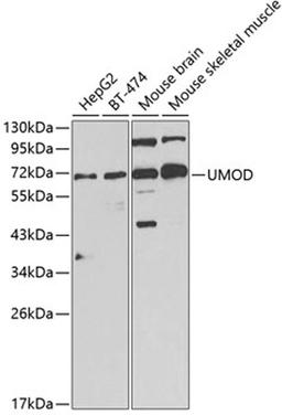 Western blot - UMOD Antibody (A1920)