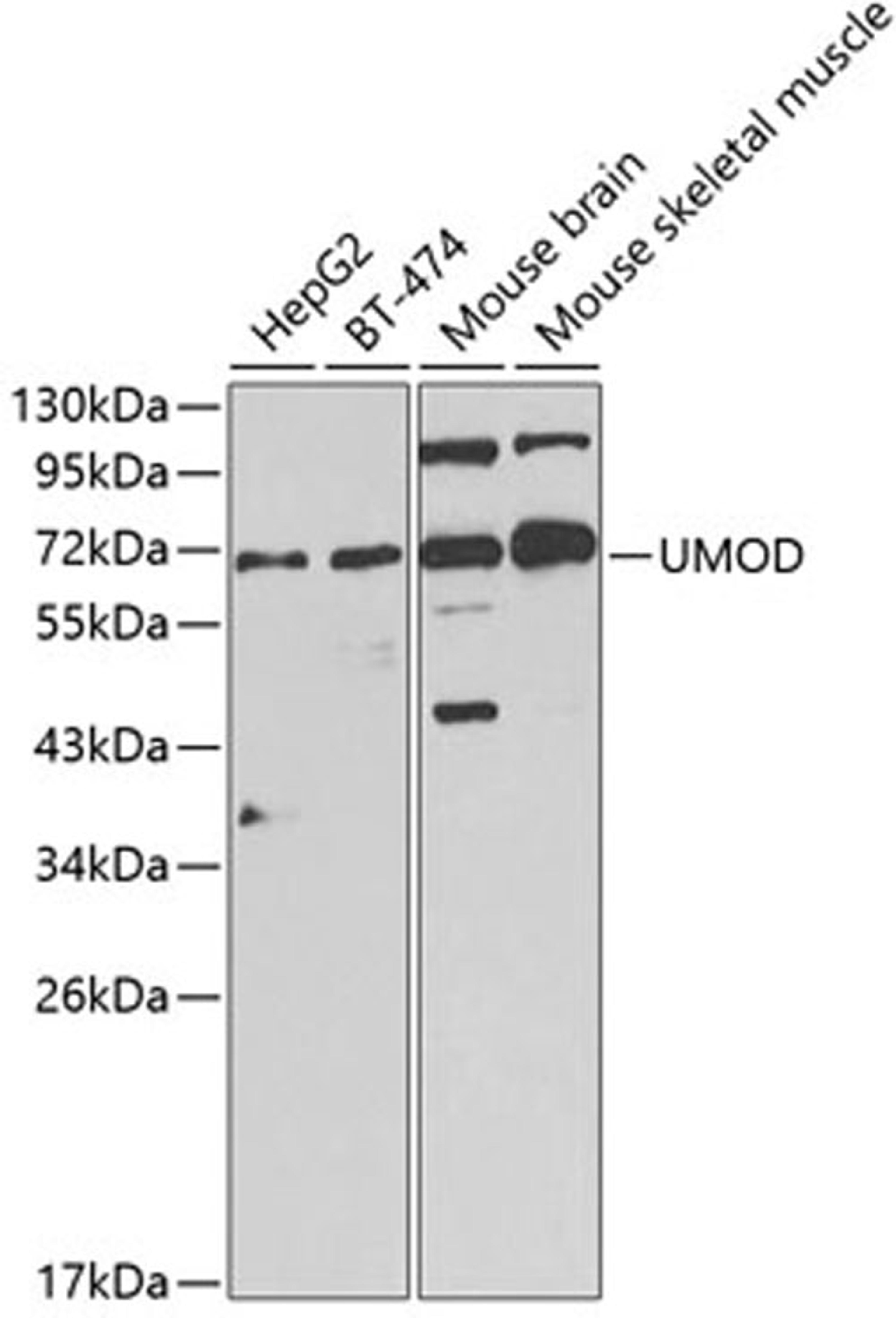 Western blot - UMOD Antibody (A1920)