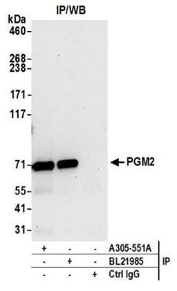 Detection of human PGM2 by western blot of immunoprecipitates.