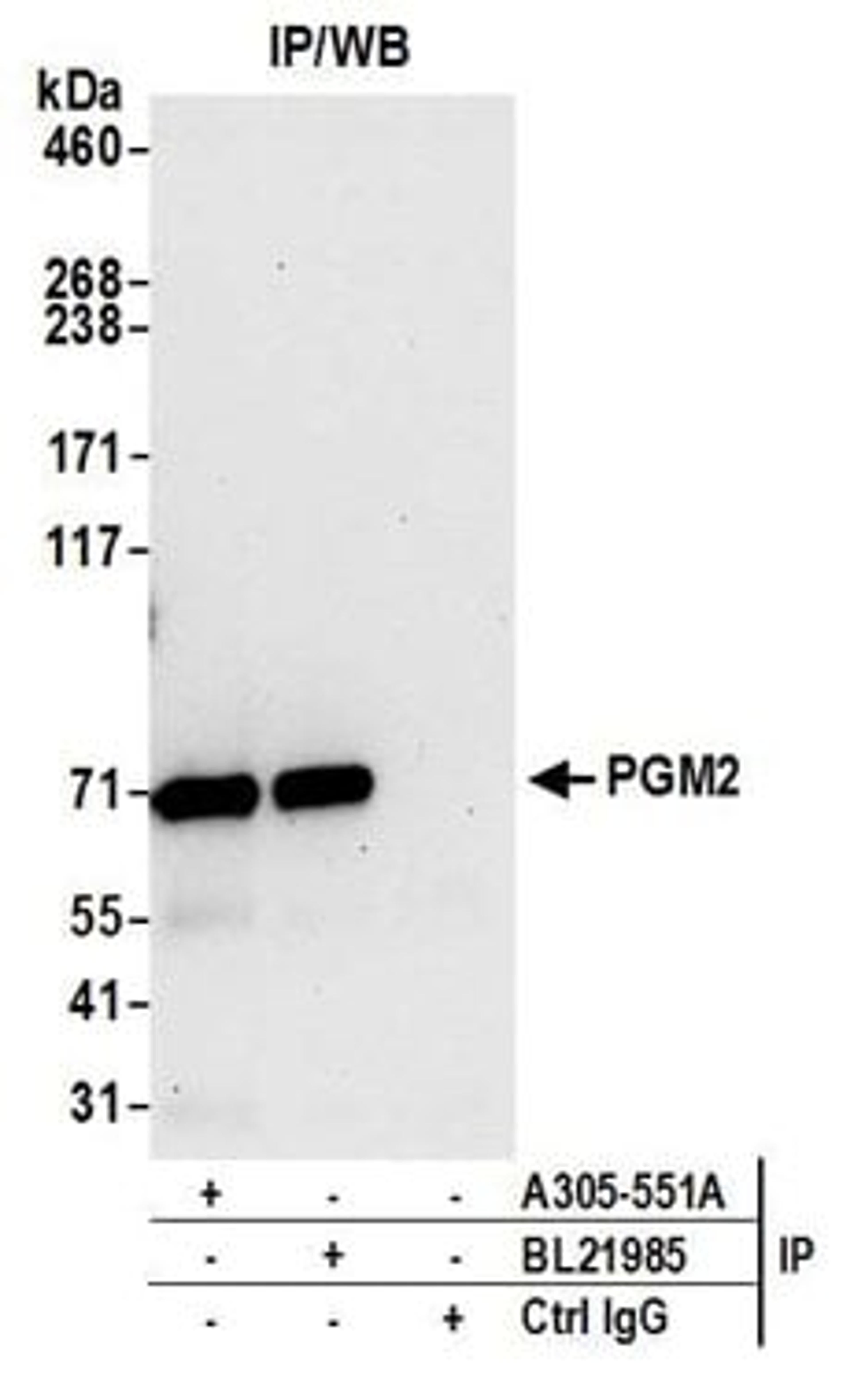 Detection of human PGM2 by western blot of immunoprecipitates.