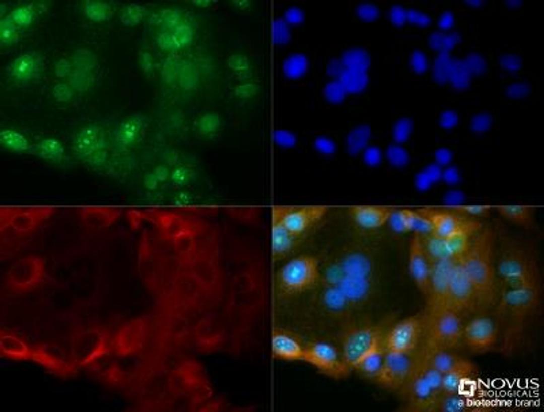 Immunocytochemistry/Immunofluorescence: Cyr61/CCN1 Antibody [NB100-356] - MCF7 cells were fixed for 10 minutes using 10% formalin and then permeabilized for 5 minutes using 1X TBS + 0.5% Triton-X100. The cells were incubated with anti-Cyr61/CCN1 (NB100-356) at a 1:200 dilution overnight at 4C and detected with an anti-rabbit Dylight 488 (Green) at a 1:500 dilution. Alpha tubulin was used as a co-stain at a 1:1000 dilution and detected with an anti-mouse Dylight 550 (Red) at a 1:500 dilution. Nuclei were counterstained with DAPI (Blue). Cells were imaged using a 40X objective.