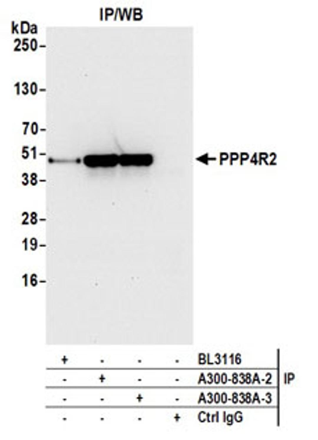 Detection of human PPP4R2 by western blot of immunoprecipitates.