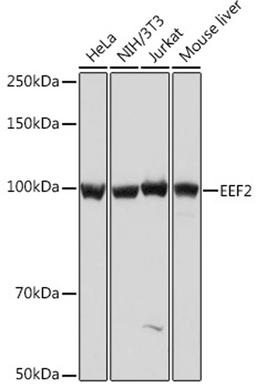 Western blot - EEF2 Rabbit mAb (A9721)