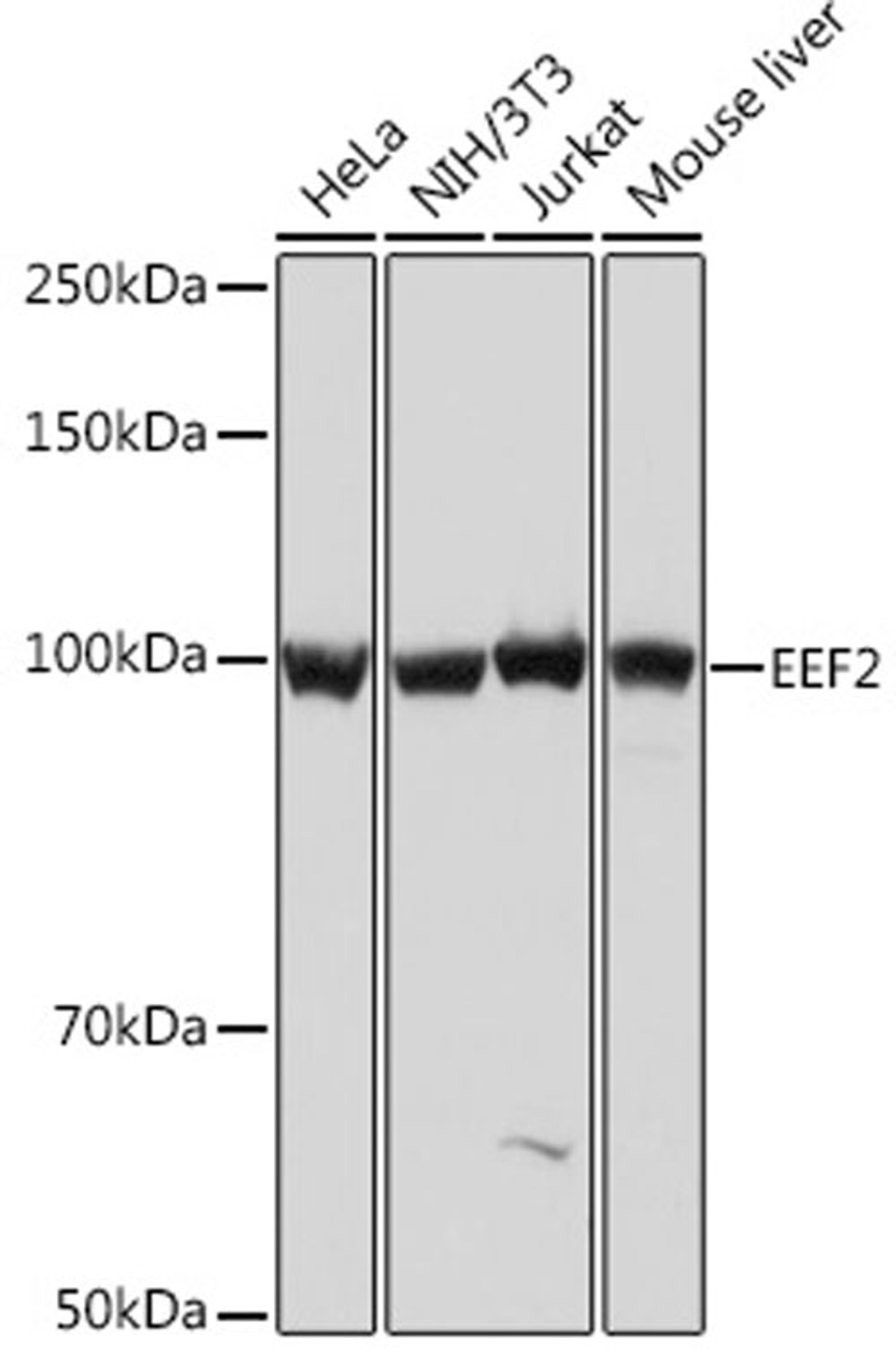 Western blot - EEF2 Rabbit mAb (A9721)