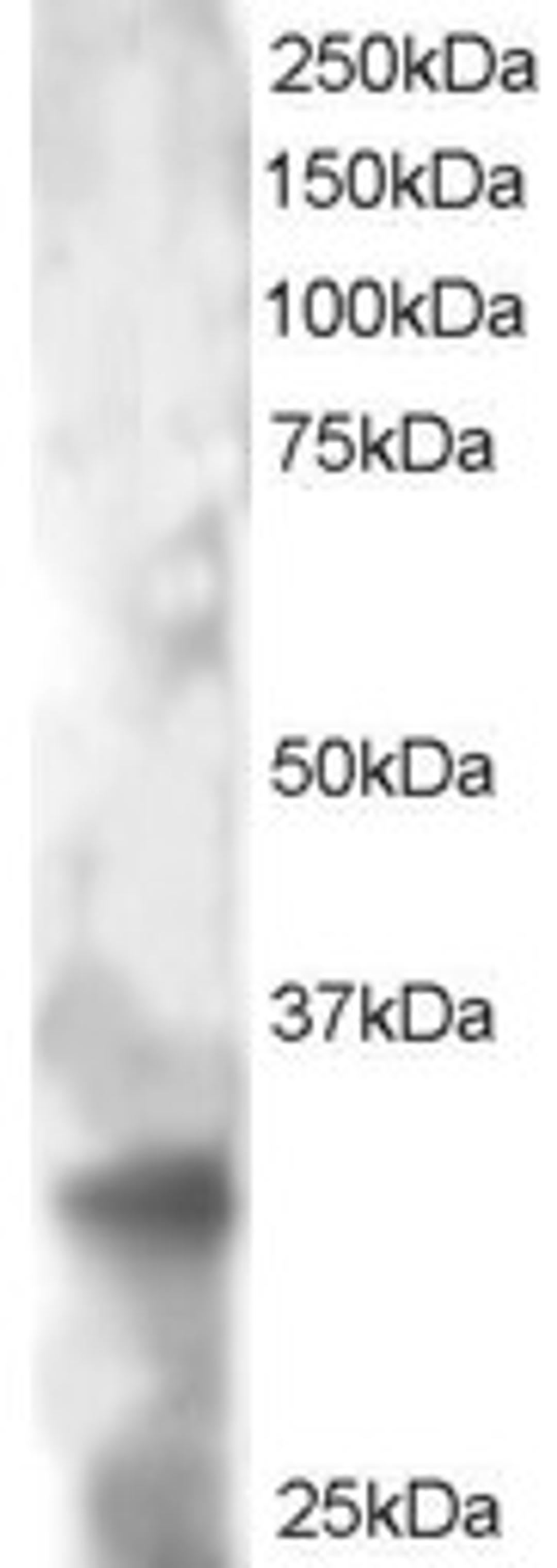 46-176 staining (2ug/ml) of HeLa lysate (RIPA buffer, 30ug total protein per lane). Primary incubated for 12 hour. Detected by western blot using chemiluminescence.