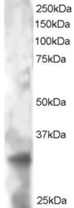 46-176 staining (2ug/ml) of HeLa lysate (RIPA buffer, 30ug total protein per lane). Primary incubated for 12 hour. Detected by western blot using chemiluminescence.