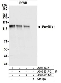 Detection of human Pumillio 1 by western blot of immunoprecipitates.