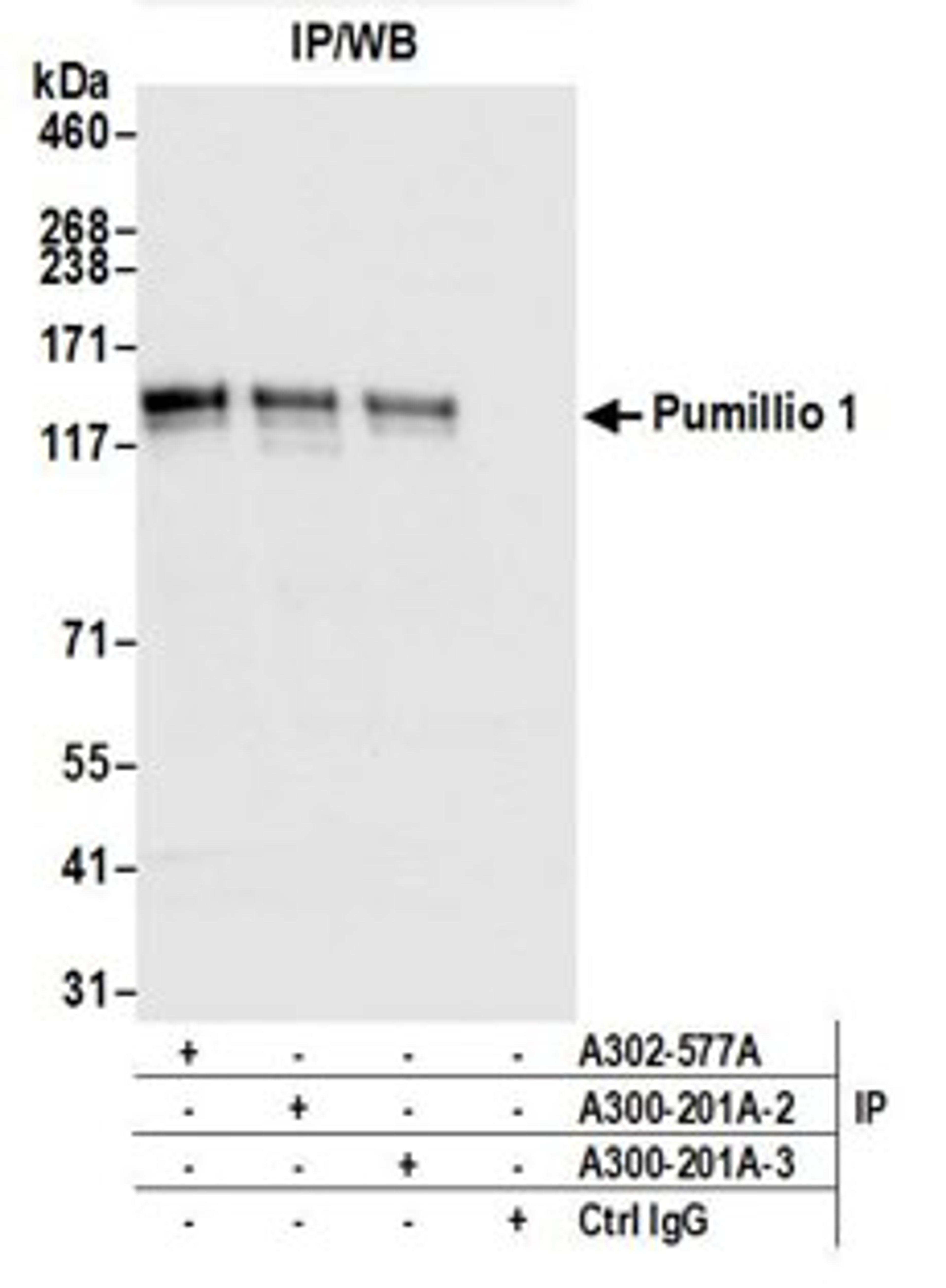 Detection of human Pumillio 1 by western blot of immunoprecipitates.