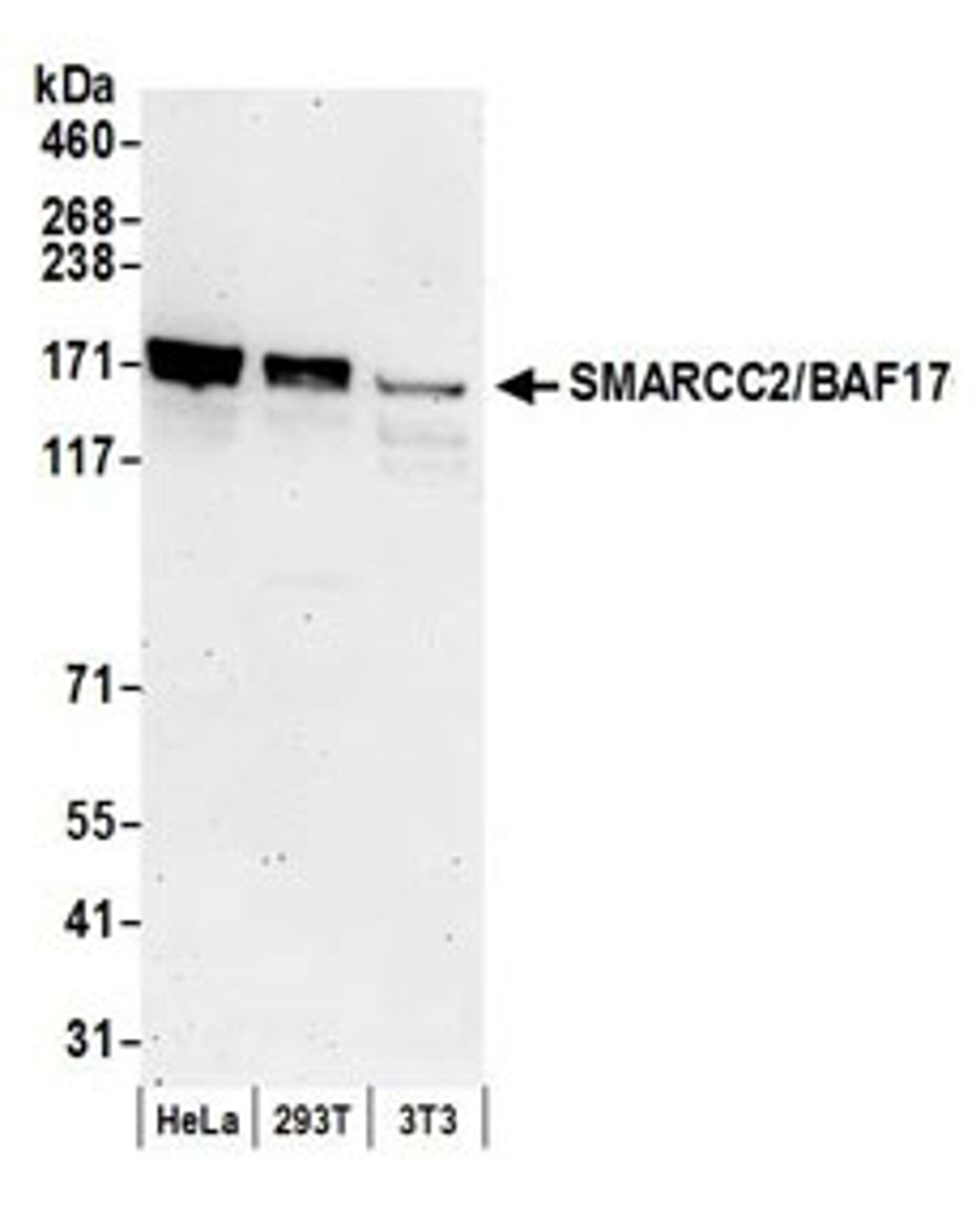 Detection of human and mouse SMARCC2/BAF170 by western blot.