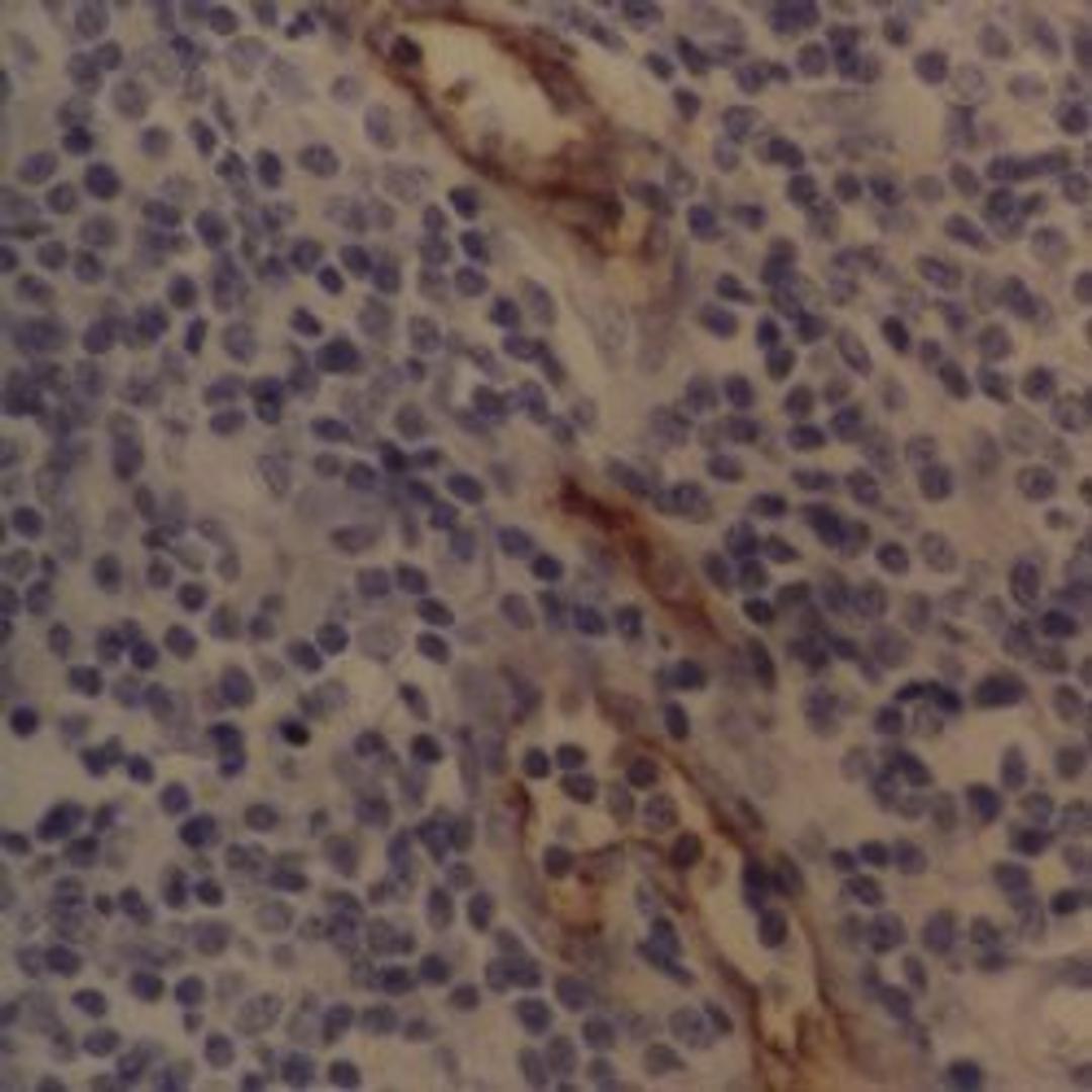 Staining of human tonsil showing capillary endothelium