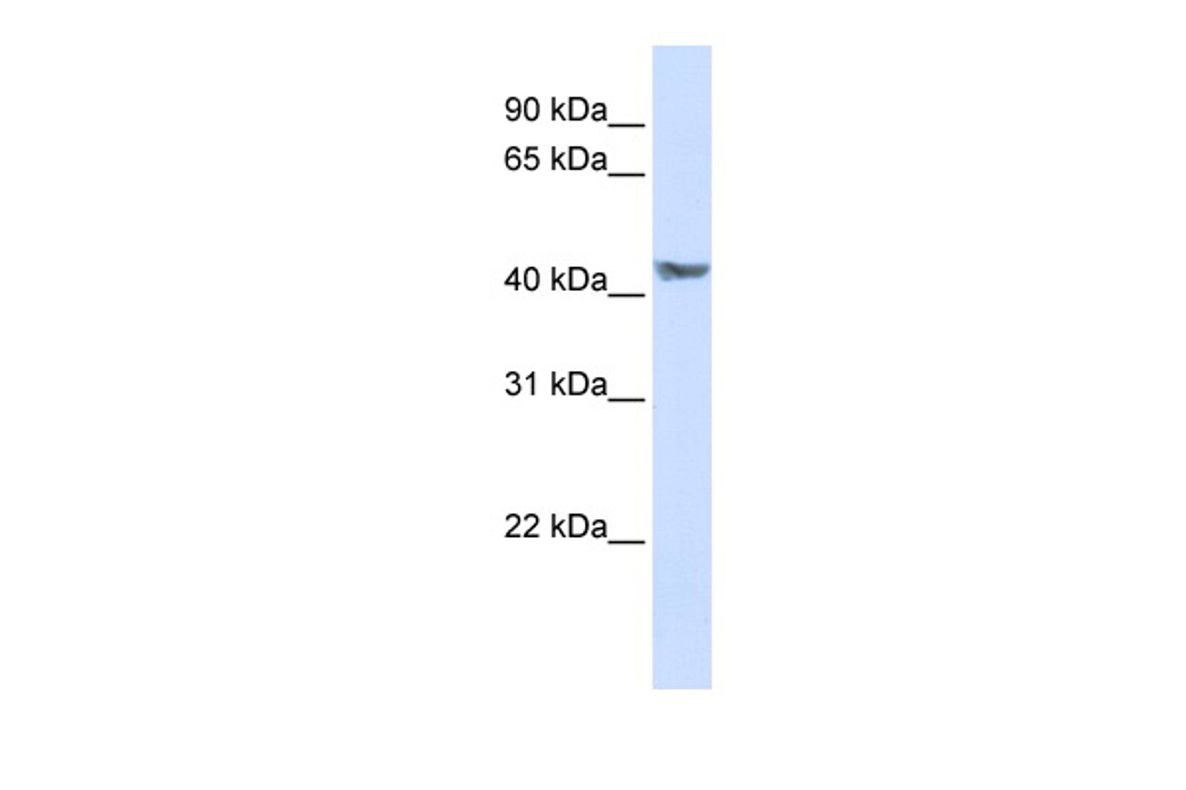 Antibody used in WB on Transfected 293T at 0.2-1 ug/ml.