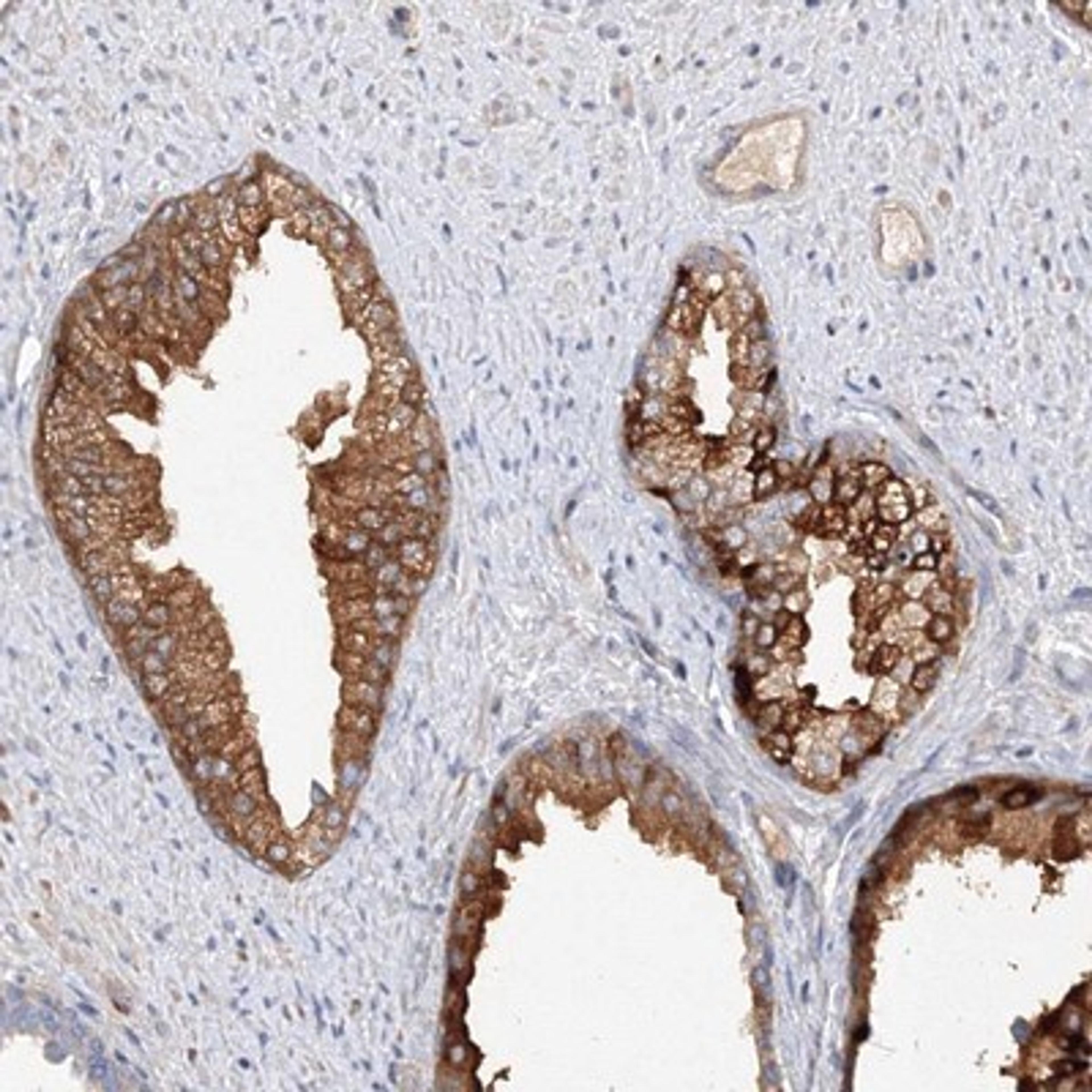 Immunohistochemistry-Paraffin: DIS3L2 Antibody [NBP1-84740] - Staining of human prostate shows strong cytoplasmic positivity in glandular cells.