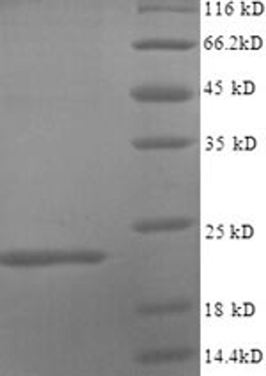 (Tris-Glycine gel) Discontinuous SDS-PAGE (reduced) with 5% enrichment gel and 15% separation gel.