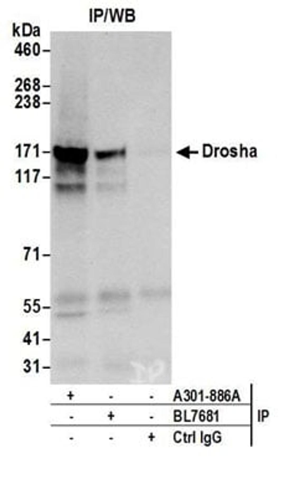 Detection of human Drosha by western blot of immunoprecipitates.