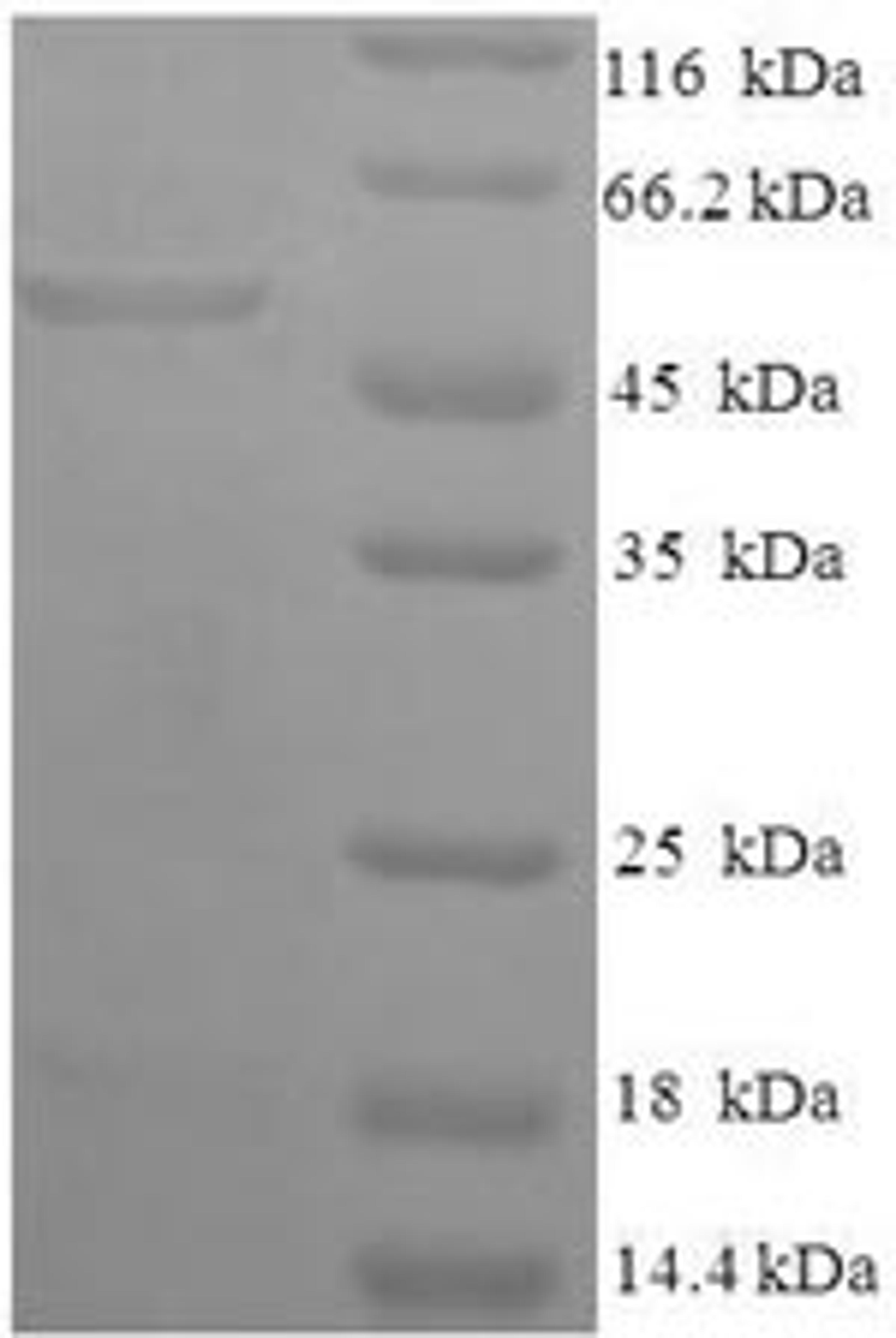 (Tris-Glycine gel) Discontinuous SDS-PAGE (reduced) with 5% enrichment gel and 15% separation gel.